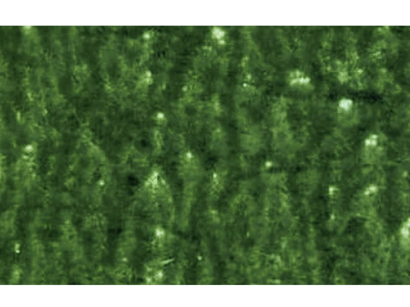 Flexo-Printing-Defects-of-Mottled Image 얼룩덜룩한 이미지의 플렉소 인쇄 결함